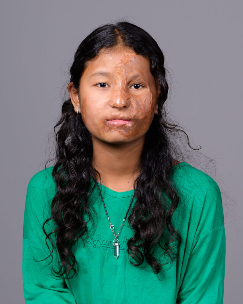 bipana